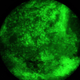 Illustration for article titled These Cancer Cells Were Spotted With a DSLR